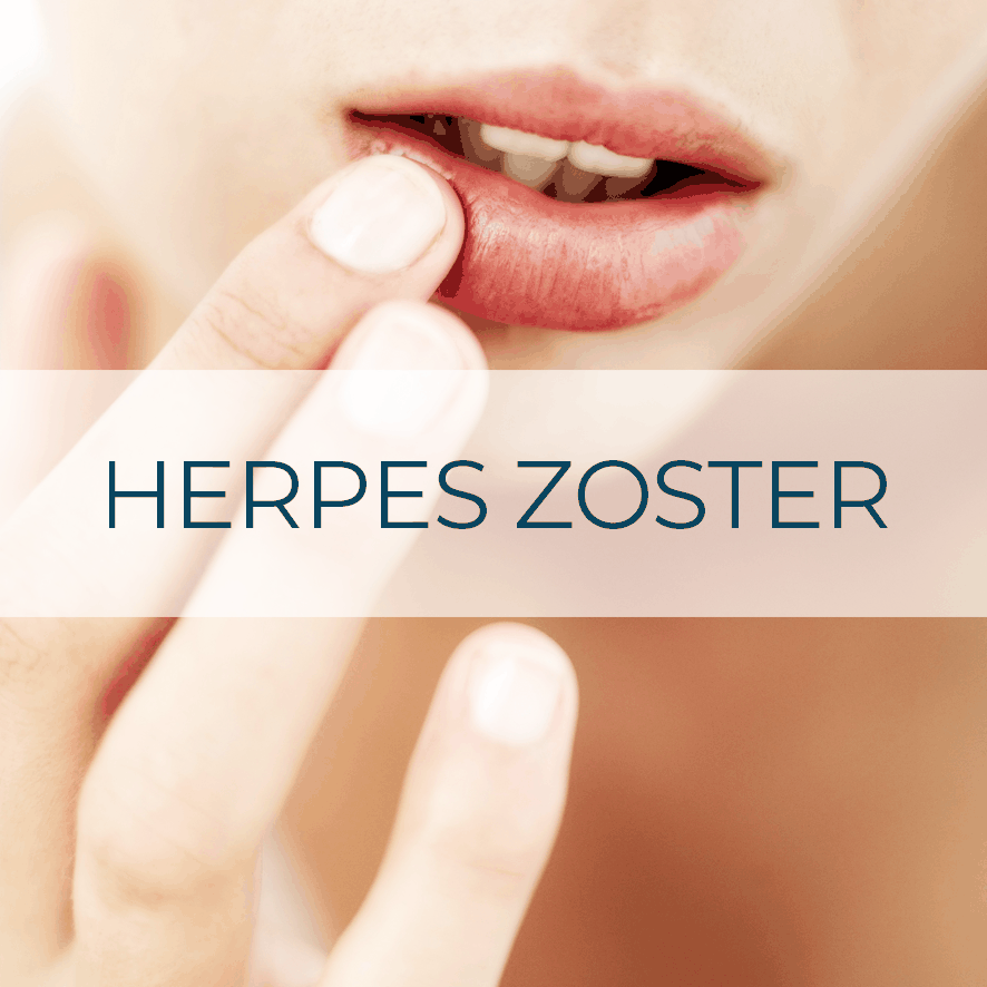 Vacuna Herpes Zóster