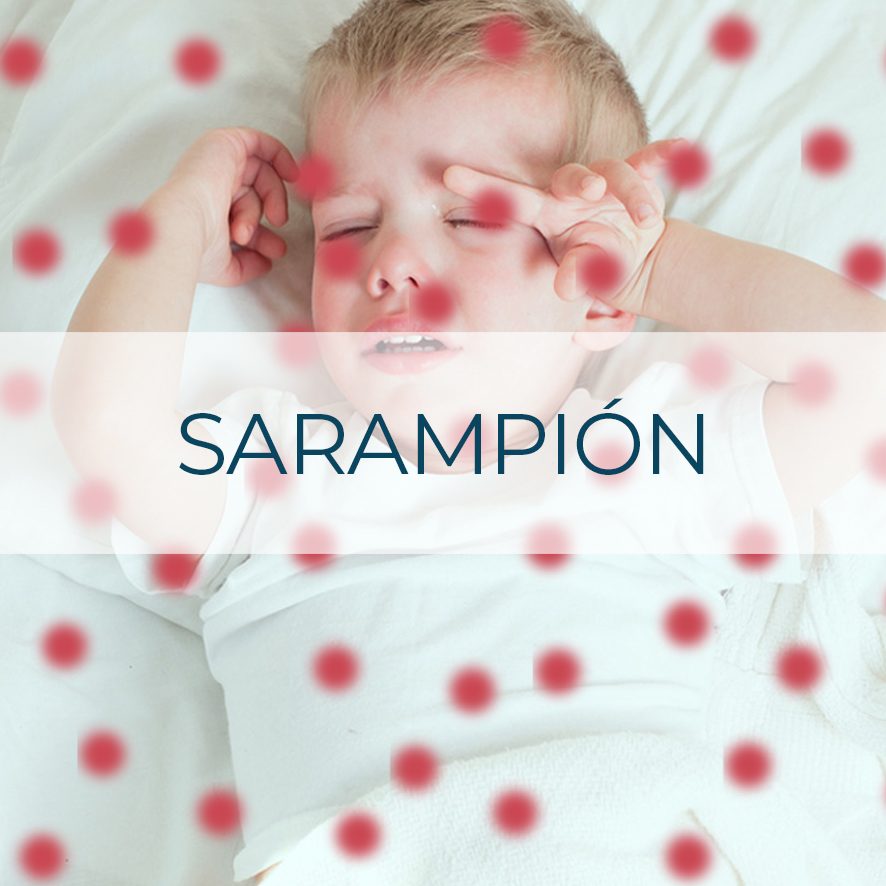 Vacuna Sarampión
