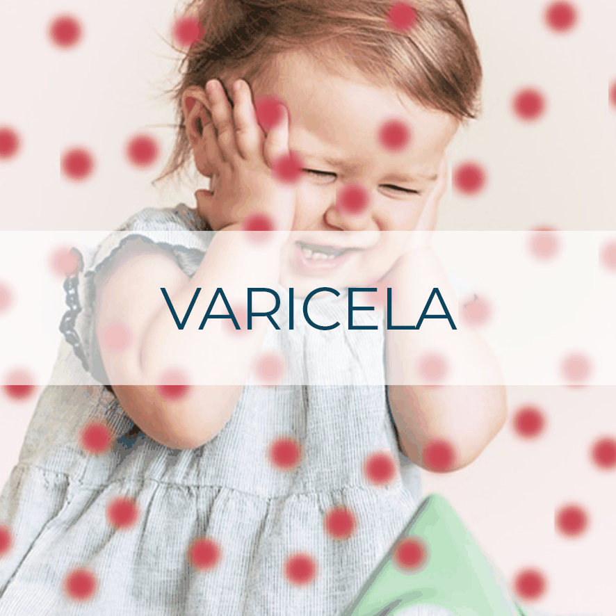 Vacuna Varicela