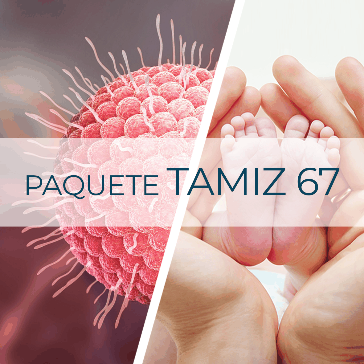 Paquete Tamiz 67