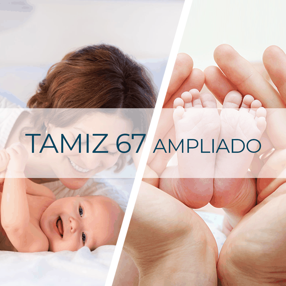 Tamiz 67 Ampliado